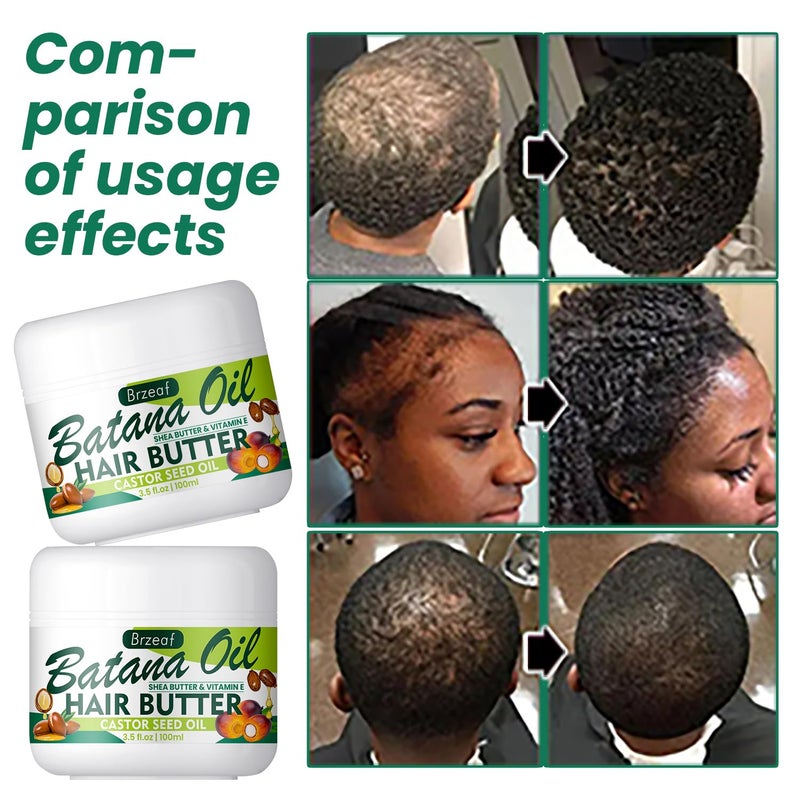 Brzeaf Natural Raw Batana Oil for Women & Men Hair Growth, 3.5 Fluid Ounces - Hair Treatment Oils for All Hair Types, Moisturizing and Nourishing Hair Oil - Image 5