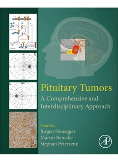 Pituitary Tumors: A Comprehensive and Interdisciplinary Approach  - Image 1