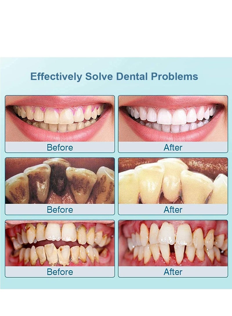 Electric Ultrasonic Dental Scaler Tooth Calculus Remover - Image 4