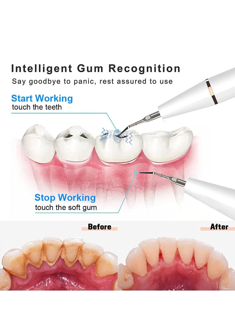 Electric Ultrasonic Dental Scaler Tooth Calculus Remover - Image 3