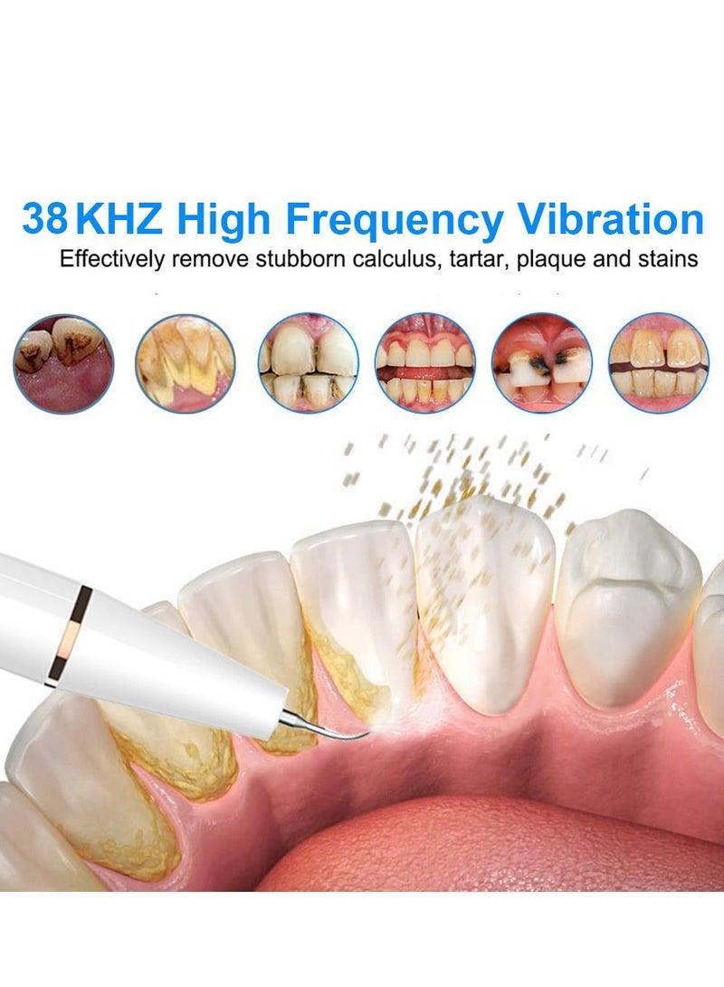 Electric Ultrasonic Dental Scaler Tooth Calculus Remover - Image 2