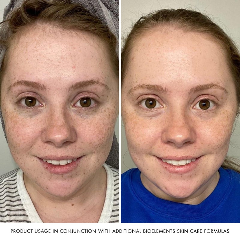 Bioelements Beyond Hydration - 2.5 fl oz - Non-Greasy Gel Facial Moisturizer for Oily Skin - Includes Vitamin B5 & Essential Oils - Vegan, Gluten Free - Never Tested on Animals - Image 5