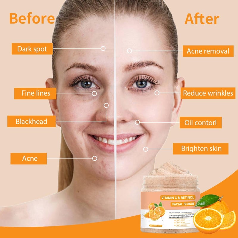 IREV Vitamin C Face Scrub, Exfoliating Facial Wash with Retinol, Facial Scrub,Facial Exfoliating Scrub, Facial Scrubs for Women,Deep Cleansing Face Wash Cleanser for Women Men - Image 2