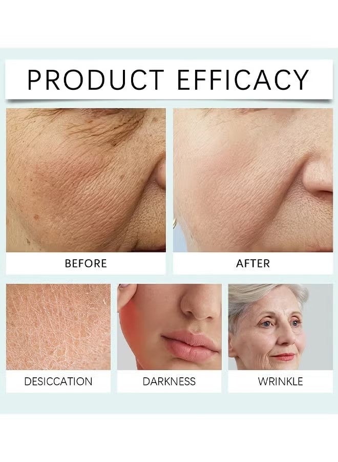 هويجي كريم الوجه 14-Day Skin Beauty Regimen Melasma, البقع العمرية البقع, التجاعيد أكثر سلاسة, كريم البقع الداكنة, لعلاج البقع والبقع لجميع أنواع الجلد, كريم الوجه المضادة للتجاعيد - Image 5