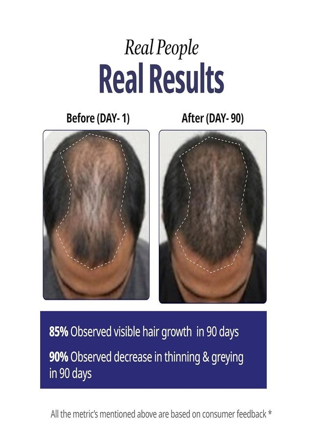 Reginald Men Athena- All in one Hair Serum | Hair Fall Control & Follicle Boost with 12 Actives | Advanced Hair Growth Serum For Scalp | Controls HairFall & Boosts New Hair Growth | For Men | 30ml - Image 4