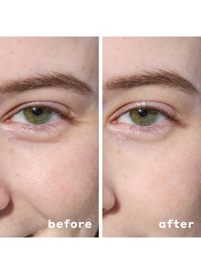 ماريو باديسكو لاصقات ماريو باديسكو هيدروجيل تحت العين (30 زوجًا) - أقنعة مرطبة للعين لعلاج انتفاخ العينين والهالات السوداء والخطوط الدقيقة، مع حمض الهيالورونيك والنياسيناميد، مهدئة وممتلئة. - Image 3