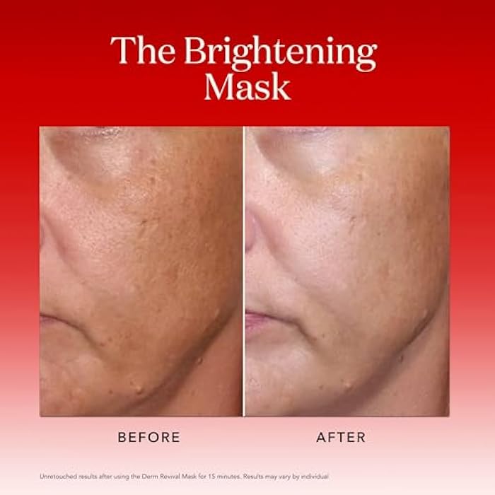 SK-II Brightening Face Mask - Derm Revival Sheet Mask to Improve Radiance, Skin Texture & Dark Spots - Enriched with PITERA, Vitamin C & Niacinamide (10 Count) - Image 5