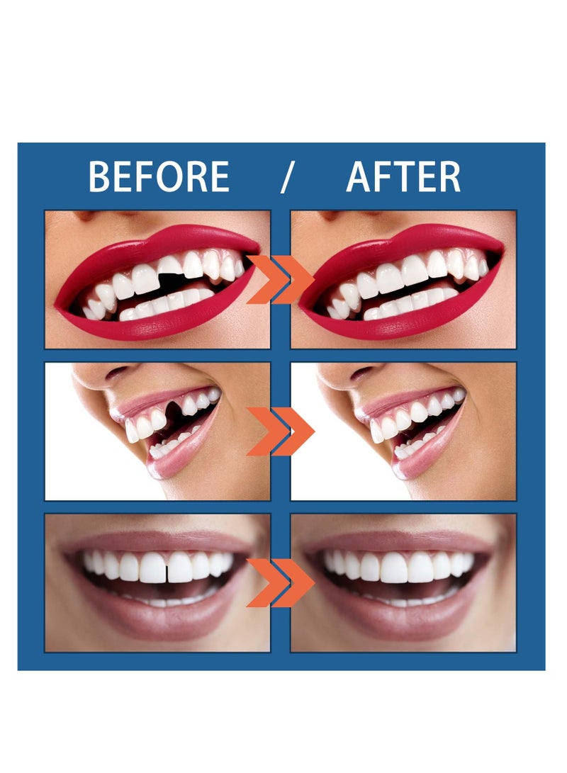 جايسوينغ 25 جرام، عضاضة صلبة لحشو الأسنان، حشوة الفتحات، عضاضة أسنان مصاصي الدماء التنكرية للهالوين - Image 3