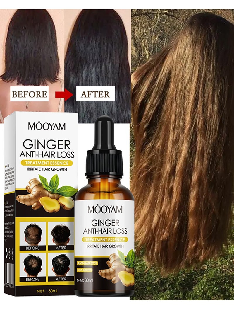 MOOYAM Ginger Hair Growth Essence 30ml Anti Hair Loss Treatment Strengthens Hair Follicles Reduces Breakage and Promotes Thicker Fuller Hair for All Hair Types - Image 1