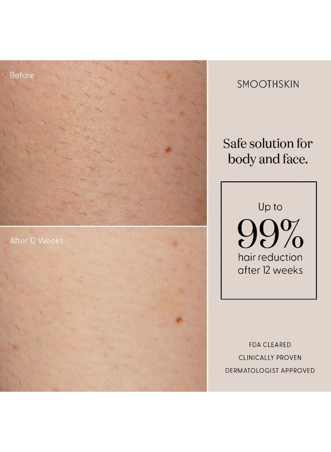 SMOOTHSKIN جهاز إزالة الشعر بالليزر IPL من SmoothSkin Pure FIT - علاجات كاملة للجسم تدوم طويلاً للنساء والرجال - Image 4