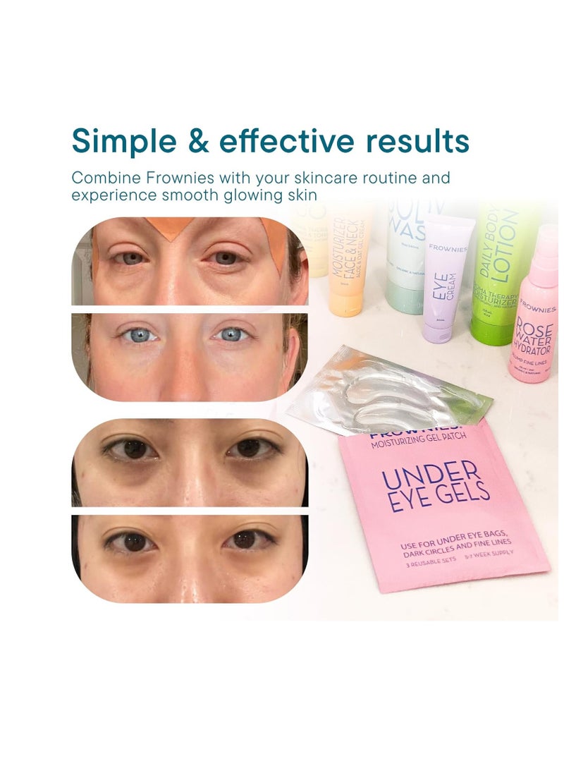 Frownies Frownies Under Eye Gel Patches for Puffy Eyes - Dark Circles with Cactus Collagen - Reusable, 3 Pack  - Image 2