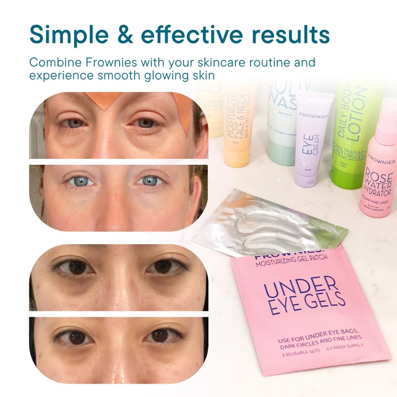 Frownies Under Eye Gel Patches for Puffy Eyes - Dark Circles with Cactus Collagen - Reusable, 3 Pack - Image 5
