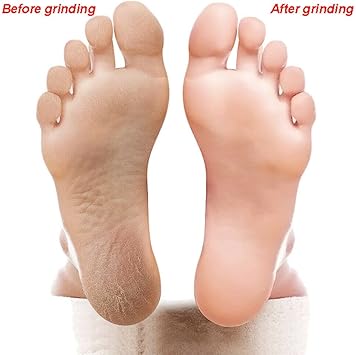 nuoshen DoubleSided Foot File 6pcs Foot Rasp Files Disposable Foot Rasp Manicure File Callus Hard Skin Remover - Image 5