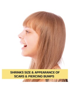 BASE LABORATORIES BASE LABORATORIES Piercing Bump Solution & Keloid Bump Removal | Soothing Piercing Aftercare for Piercing Bumps & Keloid Scar Removal | Ear & Nose Keloid Bumps Piercing Aftercare Solution Oil | 0.5 oz  - Image 4