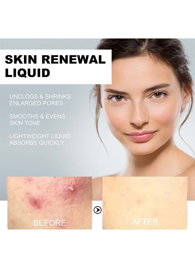 West&Month Skin Renewal liquid- pore clear 2% BHA Salicylic Acid Exfoliant Gentle Exfoliator for Blackheads Large Pores Wrinkles and Fine Lines Shrinks Enlarged Pores Smooths and Evens Skin Tone Face Exfoliator  - Image 4