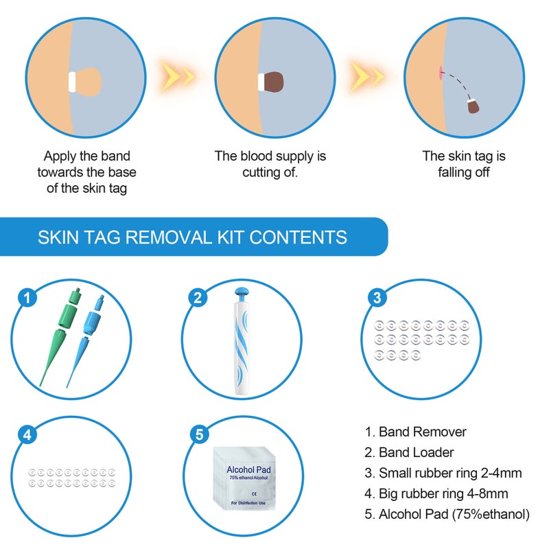 Skin Tag Removal Tool - Professional Beauty Device for Removing Warts, Moles & More - Image 3