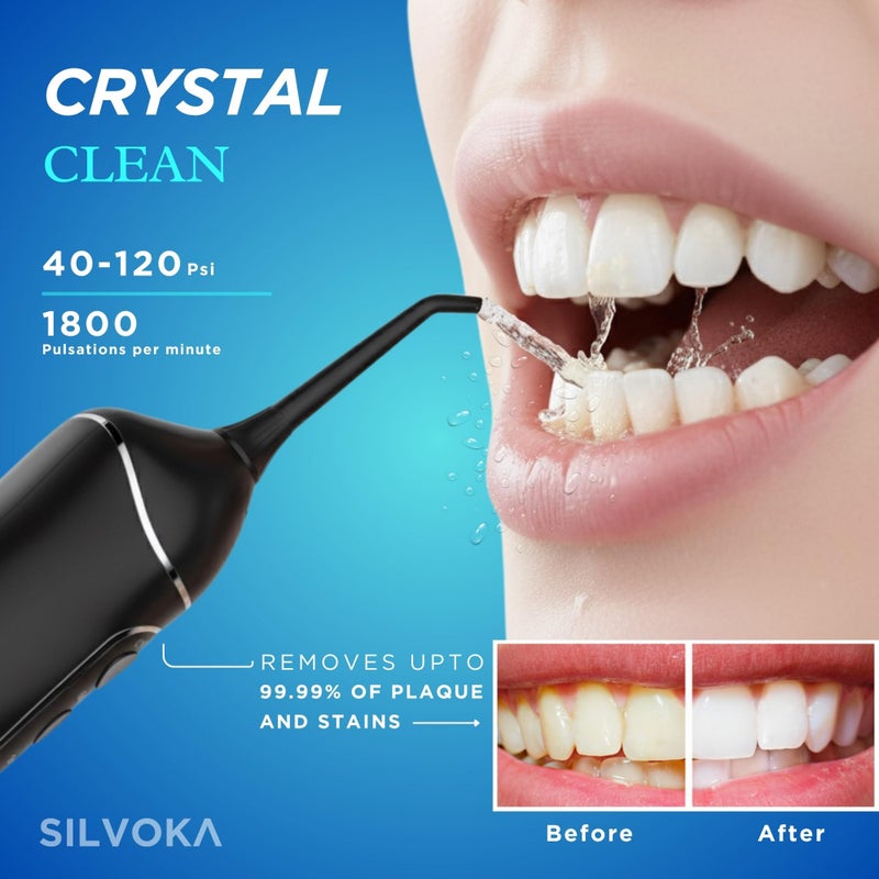 SILVOKA Water Flosser for Teeth, Cordless Oral Irrigator, Portable Dental Flosser with 300ML Tank, 4 Cleaning Modes, IPX7 Waterproof, Rechargeable Water Floss Pick for Braces, Gum Care & Travel - Image 2