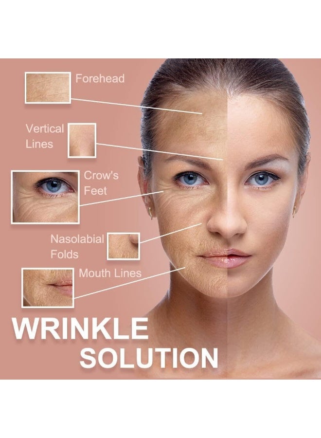 VIUAUAX لاصقات تجاعيد الوجه، لاصقات الوجه لاصقات الوجه لاصقات شد الوجه على شكل حرف V للعناية بالبشرة الرقيقة، لاصقات التجاعيد عالية المرونة شريط لاصق لشد بشرة الوجه لشد الوجه - بيج - Image 3
