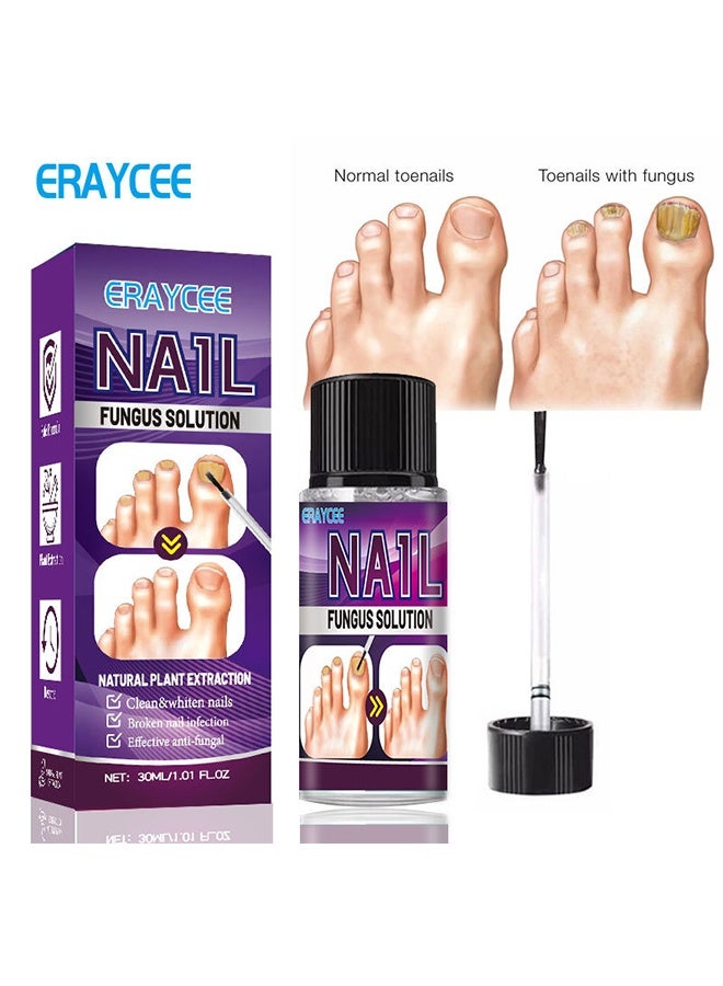 ERAYCEE Nail Fungus Solution - Fungal Nail Treatment for Toe Nail and Fingernails-Nail Repair Solution for Thick/Broken/Discolored Nails-Renews Damaged Cracked Ingrown Toenail 30ml - Image 1