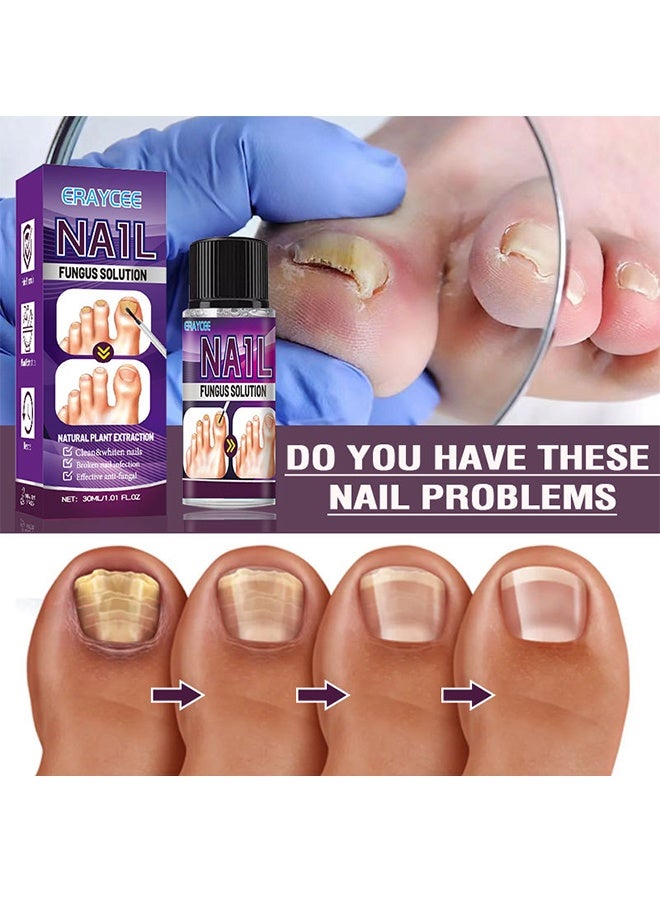 ERAYCEE Nail Fungus Solution - Fungal Nail Treatment for Toe Nail and Fingernails-Nail Repair Solution for Thick/Broken/Discolored Nails-Renews Damaged Cracked Ingrown Toenail 30ml - Image 3