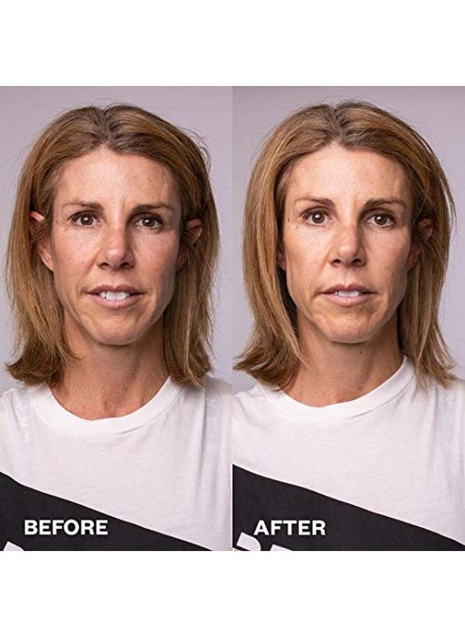 WRINKLES SCHMINKLES Face Polishing Peel Pads X5 Dailyuse Anti Aging Resurfacing Peel Pads Glycolic Acid Peel Pads To Treat Uneven Skin Tone Textured Skin Enlarged Pores & Wrinkles On Face  - Image 5