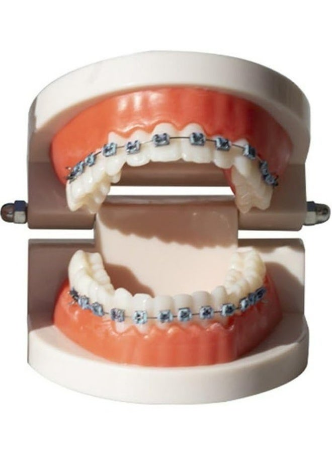 زينة أسنان مؤقتة واقعية مع أسلاك معدنية وأقواس معدنية وربطات تقويم الأسنان ودعامة تدريب طلاب طب الأسنان ومحاكاة عالية للتدريب على تقويم الأسنان وممارسة مهارة التشغيل السريري والتدريس والوسائل التعليمية لطب الأسنان باللون الأزرق - Image 3