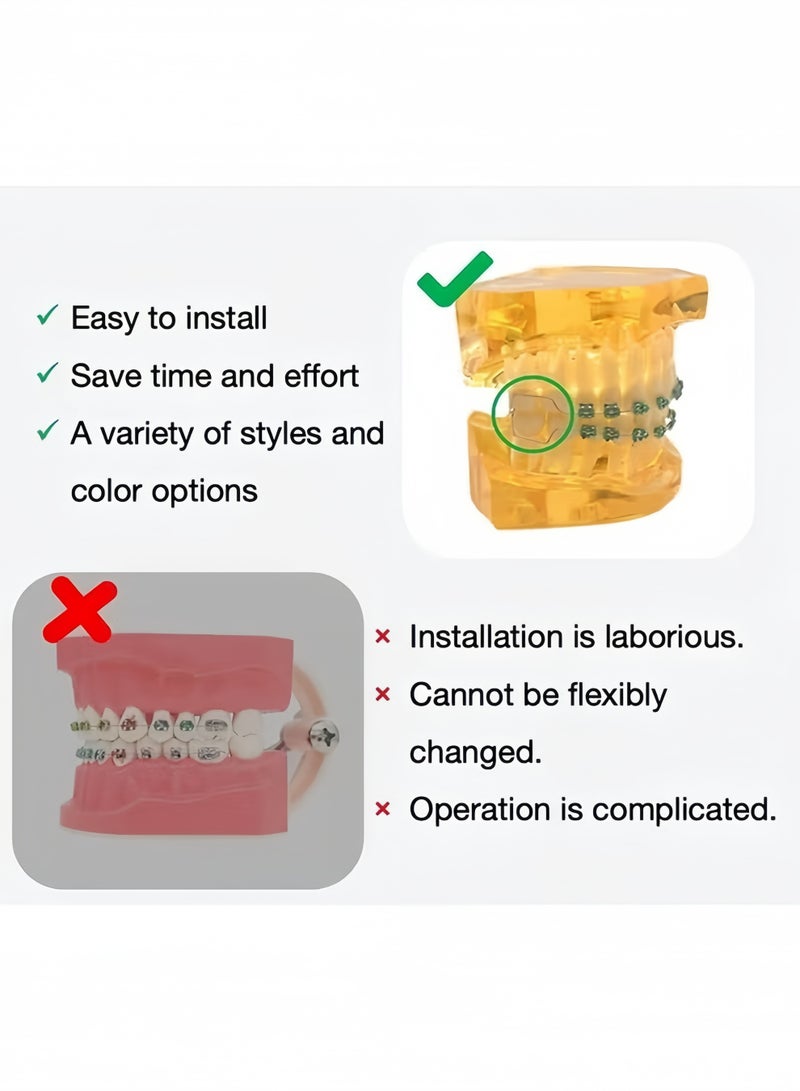 Realistic Temporary Tooth Decoration With Metal Wires Metal Brackets Orthodontic Ligature Ties Dental Student Practice Prop High Simulation For Orthodontic Training Clinical Operation Skill Practice Teaching Demonstration Dental Educational Aids Blue - Image 5
