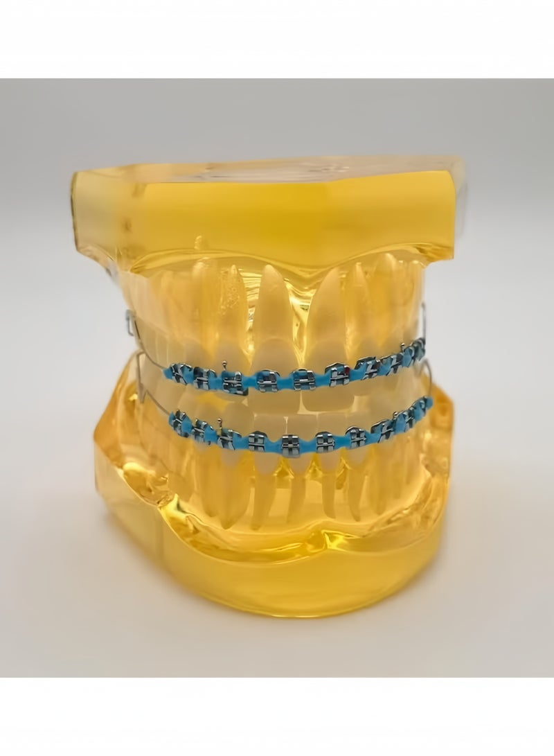 Realistic Temporary Tooth Decoration With Metal Wires Metal Brackets Orthodontic Ligature Ties Dental Student Practice Prop High Simulation For Orthodontic Training Clinical Operation Skill Practice Teaching Demonstration Dental Educational Aids Blue - Image 4