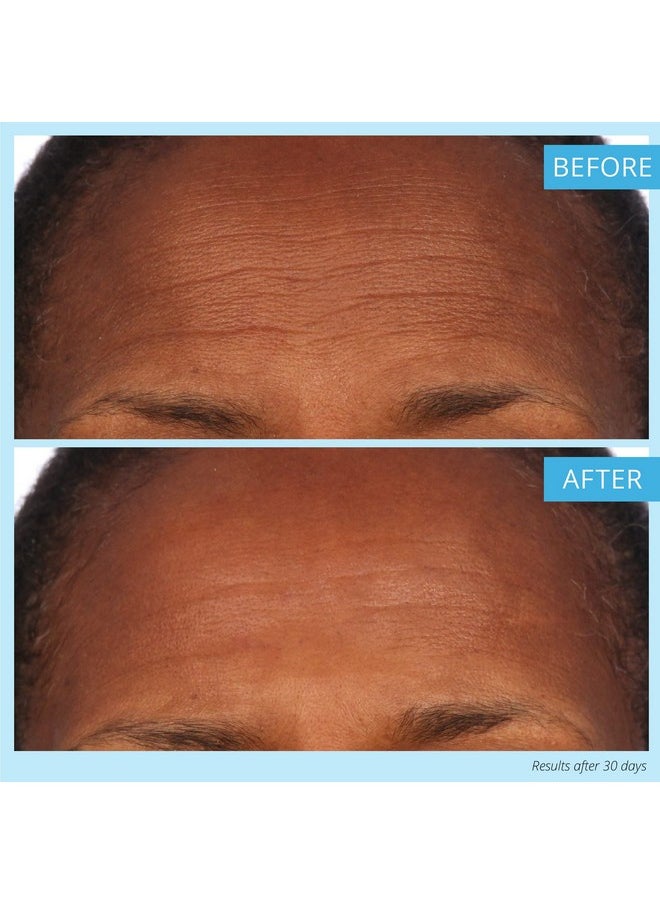 سكن علاج تقشير البشرة الدقيق DermAppeal® من SKINN لبشرة أكثر نعومة وإشراقًا ونقاءً، 2 أونصة - مقشر للوجه يزيل الجلد الميت وينعم التجاعيد والخطوط الدقيقة للحصول على بشرة خالية من العيوب ومتوهجة  - Image 3