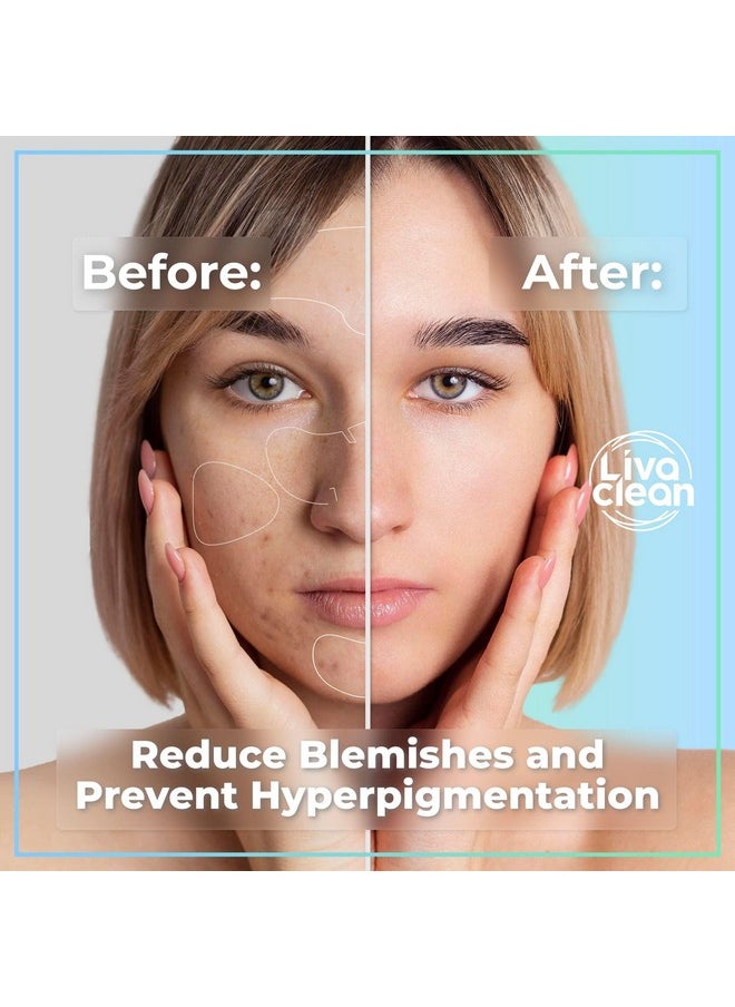 15 Ct Hydrocolloid Face Mask Pore Nose Chin Zit Full Face Pimple Patches Large Big Hydrocolloid Zit Patches Large Hydrocolloid Patch Strips Large Pimple Patch Nose Patch Hydrocolloid