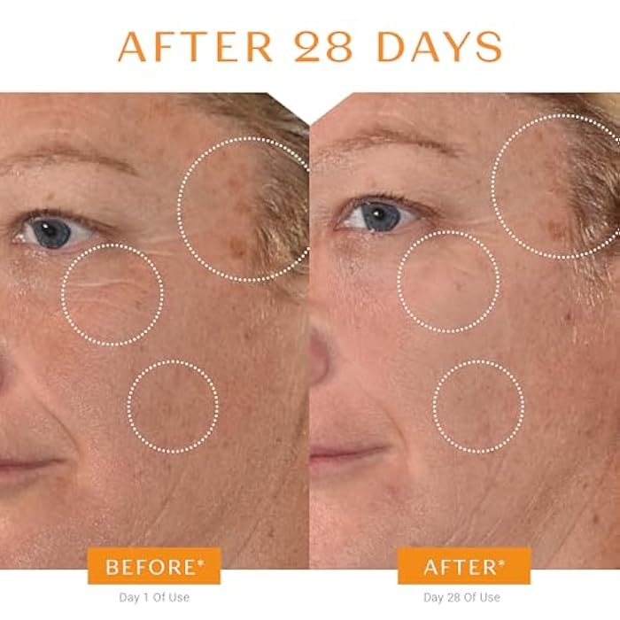 Yonka Yon-Ka Vitamin C Face Serum | Anti-Aging Face Serum for Sensitive Skin | High Concentrate to Treat Wrinkles & Uneven Skin Texture - Image 4