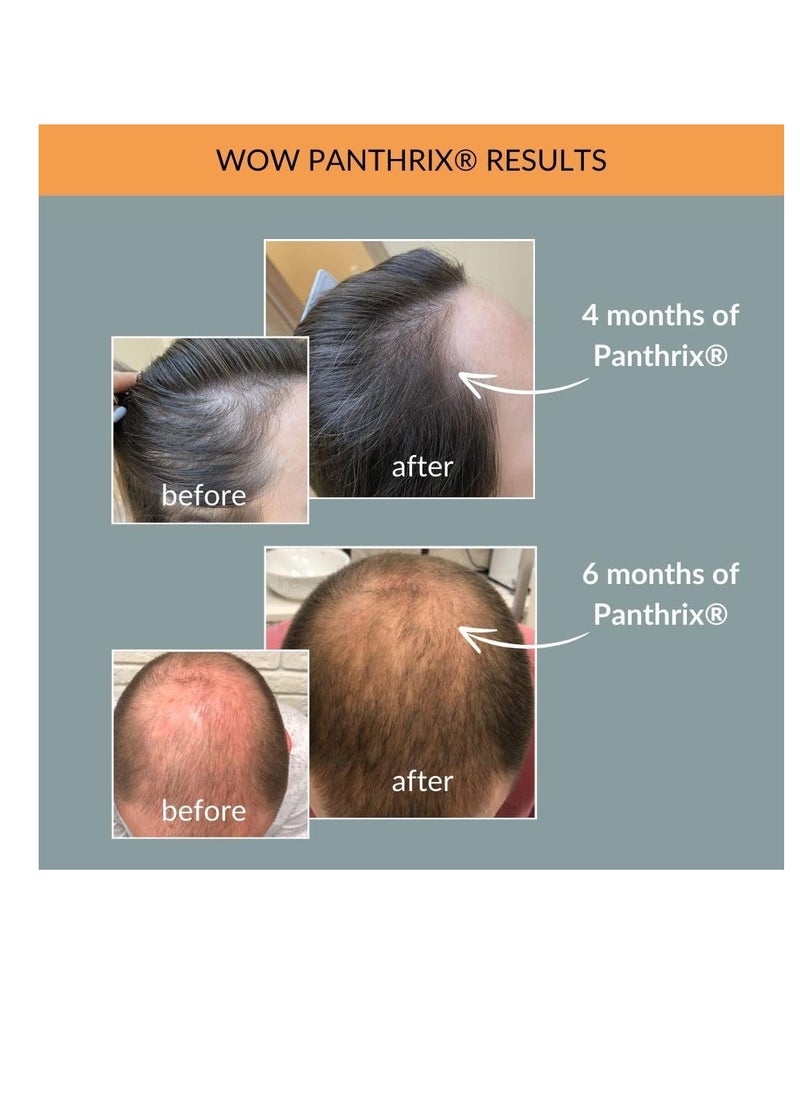 Panthrix - Hair growth activator | New | Award-winning active ingredient | MADE IN GERMANY | 100ml high-dose spray | Tonic for quick hair growth | Men & women - Image 1
