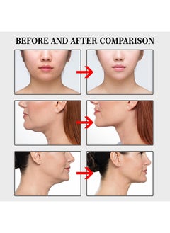 Jaysuing V Shaped Invisible Tape 100 Pieces Soft Elastic Face Adhesive Tape High Viscosity Strong Elasticity Invisible And Easy To Use For Women  - Image 5