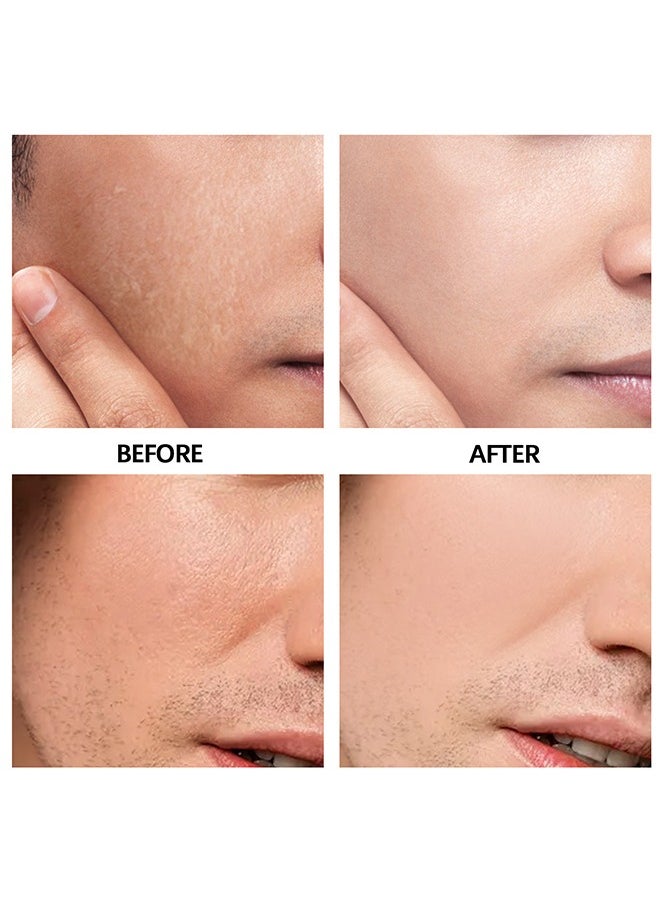 EELHOE - Moisturizing Balm - Men's Face Cream, Refreshing Face,Moisturizing Treatment, Shrinking Pores, Has The Effect Of Reducing Skin Sagging, Suitable For All Skin Types 50ML - Image 1