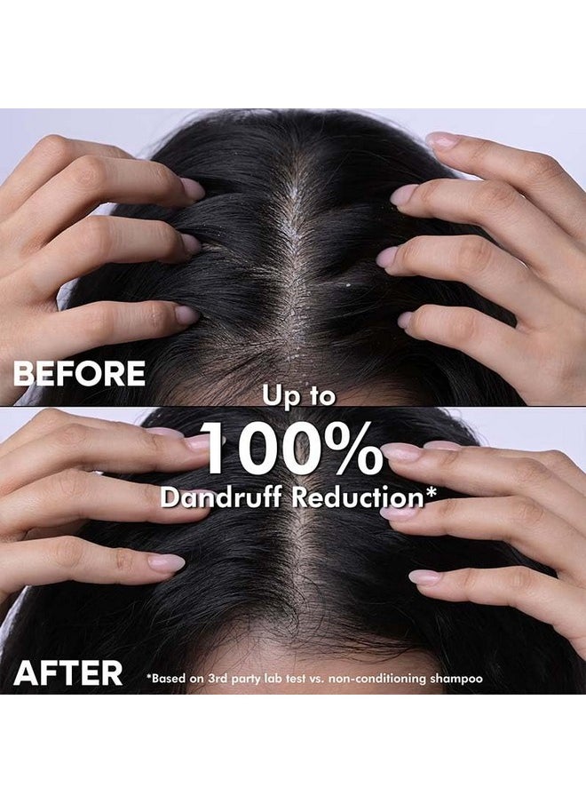 Naturali - Dandruff Defence Shampoo With Tea Tree Oil & Cactus Extracts | Prevents Dandruff | Paraben And Sulphate Free Shampoo | Anti Dandruff Shampoo (370Ml) - Image 1