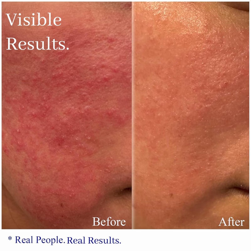 Hey Honey كريم راحة الوردية للبشرة الحساسة من هي هاني للعناية بالبشرة | مرطب مهدئ للوجه للاحمرار والتهيج | مختبر من قبل أطباء الجلد، خالي من الزيوت مع العسل والبروبوليس | 2.2 أونصة - Image 2