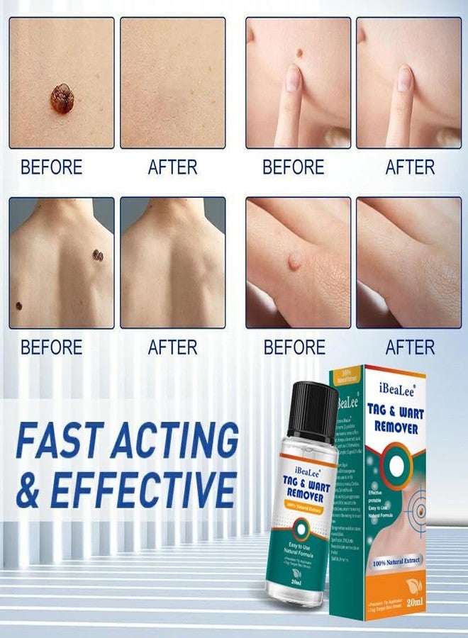Jendfert Wart Remover Liquid - 12% Wart Liquid with Salicylic Acid - Fast Acting Wart Freeze Off，for Warts, Plantar Wart, Genital Wart, Common Wart, Flat Wart, Corn, Callus（20ml） - Image 4