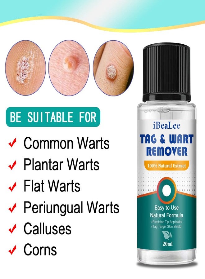 Jendfert Wart Remover Liquid - 12% Wart Liquid with Salicylic Acid - Fast Acting Wart Freeze Off，for Warts, Plantar Wart, Genital Wart, Common Wart, Flat Wart, Corn, Callus（20ml） - Image 2