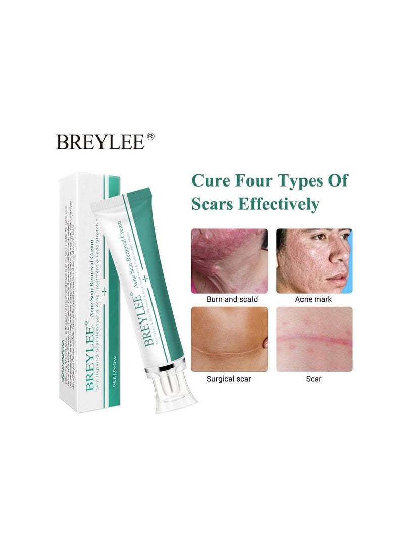 Acne Scar Removal Face Cream Skin Repair Care Remove Stretch Marks Whitening Cream (30g)