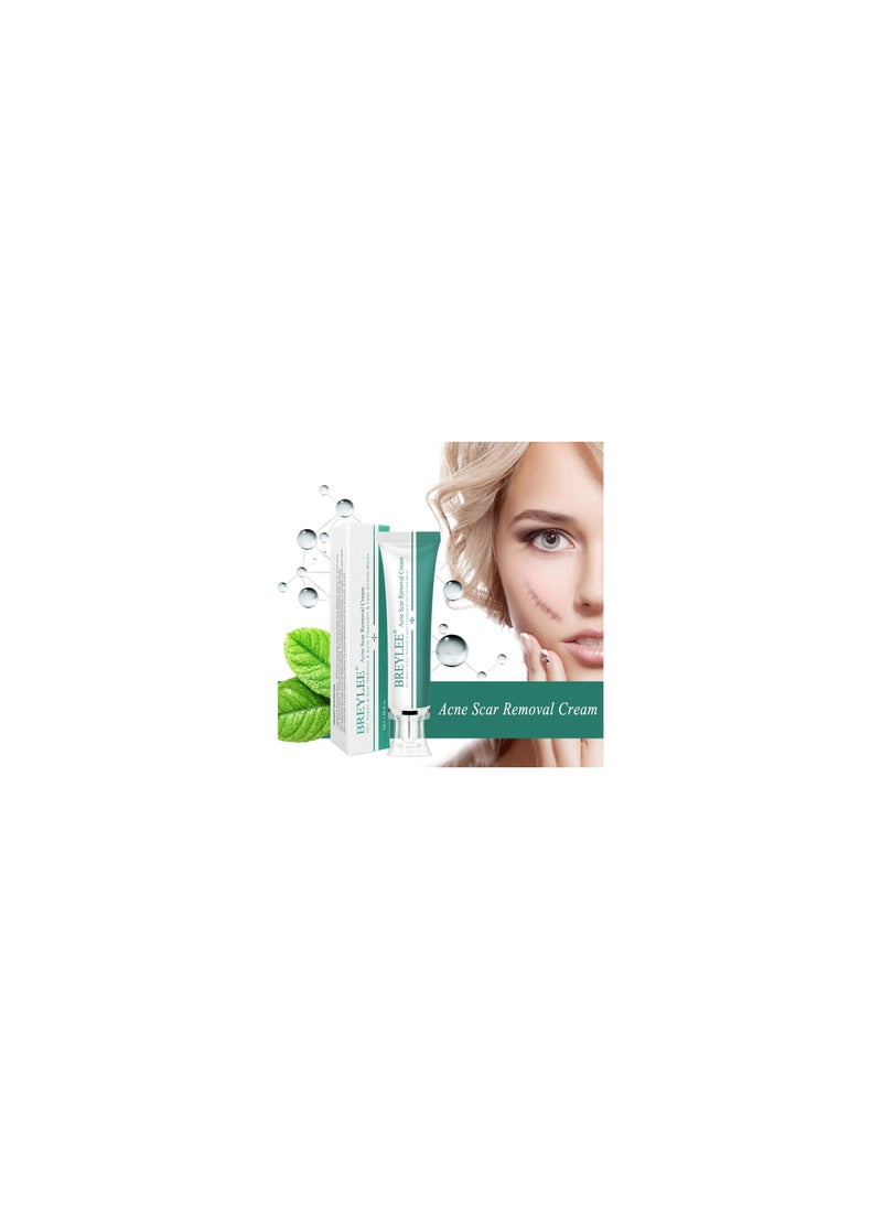 Acne Scar Removal Face Cream Skin Repair Care Remove Stretch Marks Whitening Cream (30g)