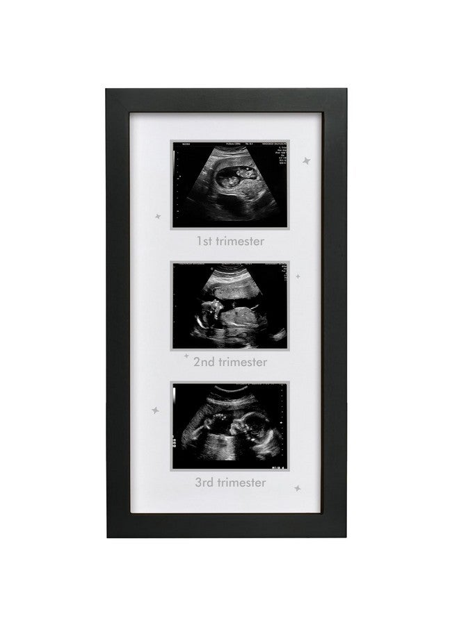 HAMUIERS Ultrasound Picture Frame - Triple Sonogram Frame for Mom to Be | Pregnancy Photo Album Decor | Baby Nursery Essentials & Gender Reveal Gifts | First Trimester Keepsake & Pregnancy Must Haves - Black2 - Image 1