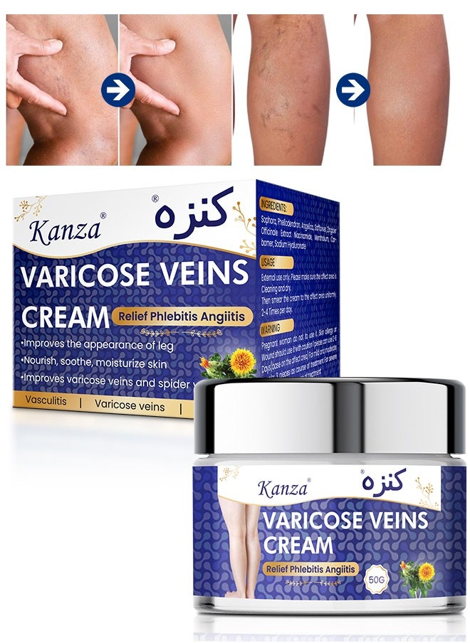 Kanza - Varicose Veins Cream 50g Relief Phlebitis Angiitis 100% Natural Ingredients Added Eliminate the Appearance of Varicose Veins Repair Soothing Leg Cream for Healing Varicose Veins for Men & Women - Image 1