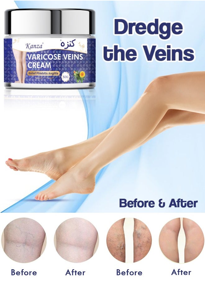 Kanza - Varicose Veins Cream 50g Relief Phlebitis Angiitis 100% Natural Ingredients Added Eliminate the Appearance of Varicose Veins Repair Soothing Leg Cream for Healing Varicose Veins for Men & Women - Image 1