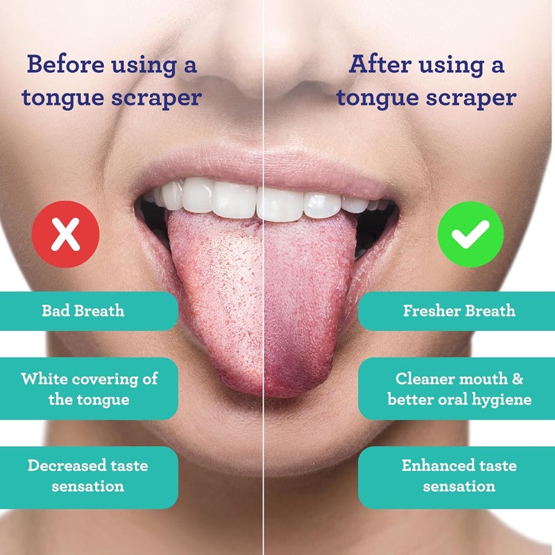 GuruNanda Tongue Scraper, Stainless Steel for Oral Hygiene, Bad Breath Treatment, Medical Grade 100% Cleaner with Travel Case Adults & Kids, Silver, 2 Count (Pack of 1) U Shaped - Image 2