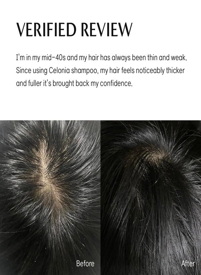CELINO CELONIA NGF 574H Bio Cell Care Shampoo, Primed Bio Stem Cell For Healthy Scalp, Hair Regrowth And Anti Hair Loss, Revitalize Dry Flaky & Itchy Scalp, Great For Sensitive Scalp. 300ml - Image 5