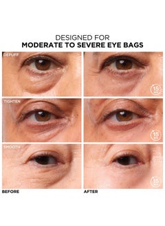 IT COSMETICS IT Cosmetics Bye Bye Under Eye Bags Treatment For Women & Men - Temporary Eye Bag Reducer & Under Eye Corrector Depuffs, Tightens, Smooths & Reduces Look of Wrinkles & Fine Lines - 0.5 Fl. Oz  - Image 2