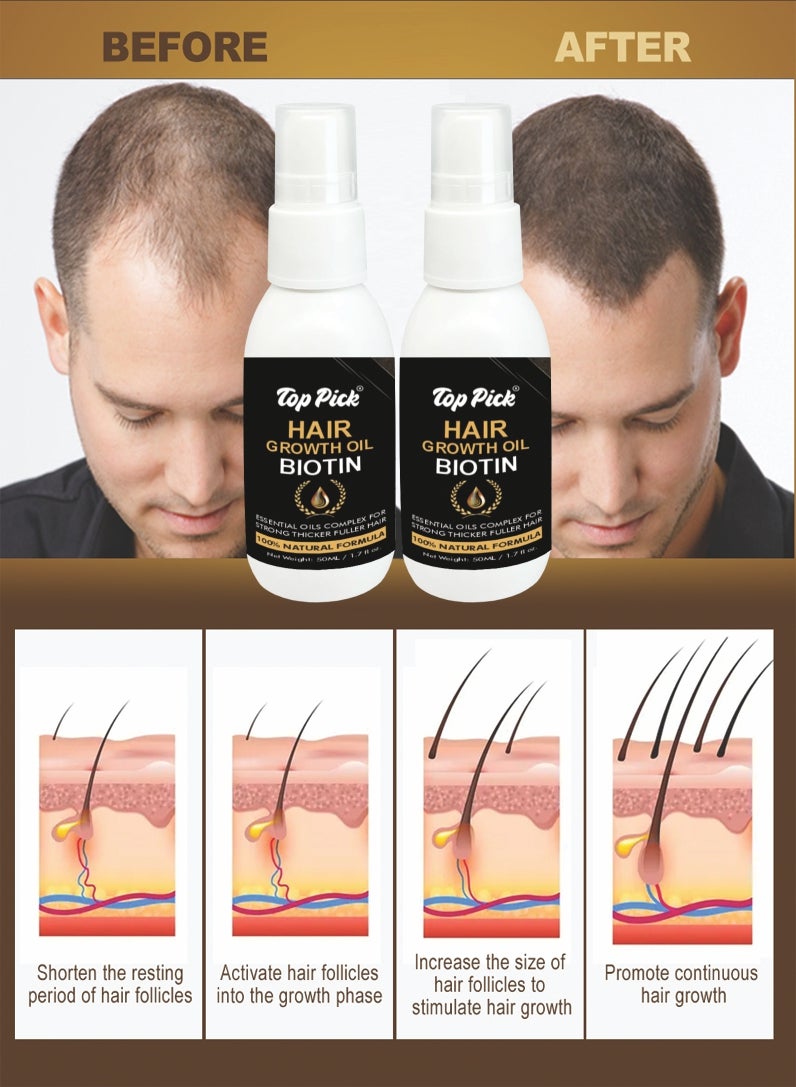 Top Pick ELEVATE Hair Growth Oil - Biotin Serum & Castor Oil Natural Vitamin Treatment for Stronger, Thicker, Longer Hair and Regrowth - Prevent Thinning and Loss for Men & Women, 50ML Pack Of 2