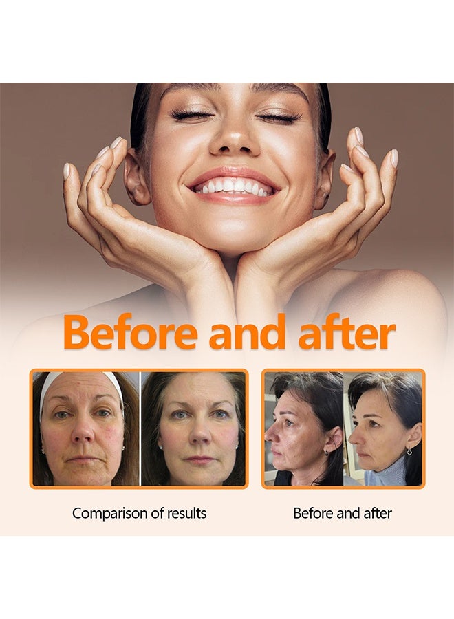 أوهو سيروم فيتامين سي 30 مل - مصل الوجه لتصحيح البقع الداكنة ، مصل فيتامين سي مع حمض الهيالورونيك وحمض الفيروليك ، وفيت إي - مصل مضاد للشيخوخة وتفتيح البشرة ، مصل فيتامين سي نقي للعناية بالبشرة - Image 5