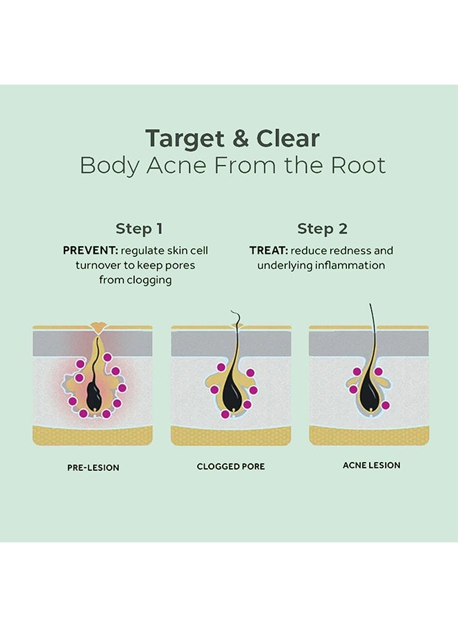 EELHOE Back Acne Soothing Spray 120ml -Tea Tree Oil Spray,Body Acne Treatment with Herbal Formula, Acne Treatment For Teens, Back Acne  - Image 4