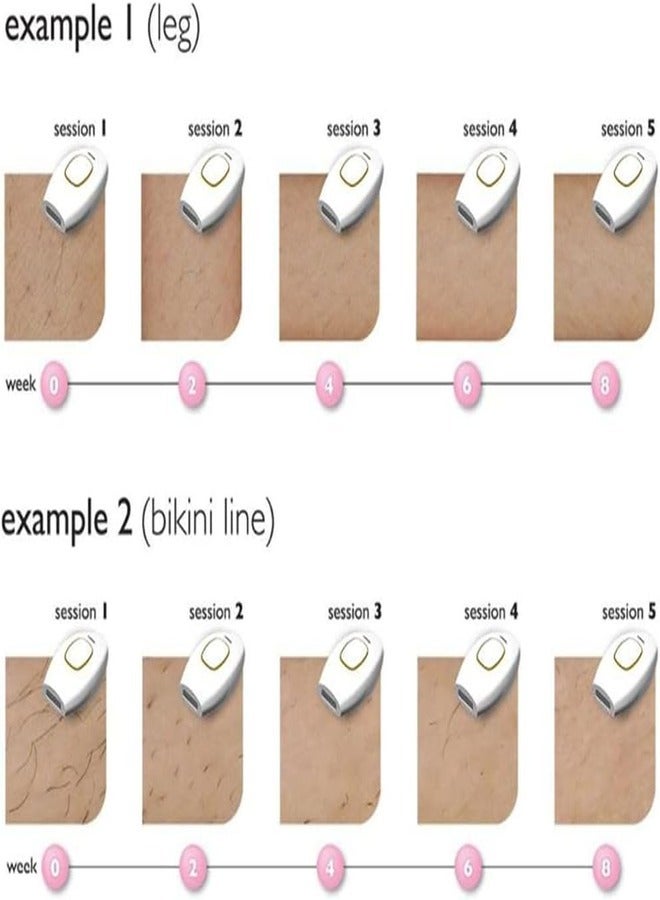Generic Painless Laser Hair Removal Device Ergonomic Design Long Lasting Results Safe and Gentle Suitable for Home use  - Image 4